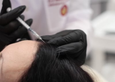 Мезотерапия за коса Hair Revitalizing Promoitalia